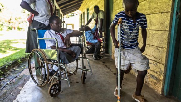 Anthony from Kenya, is seen here with a new bespoke crutch. and prosthetic leg.