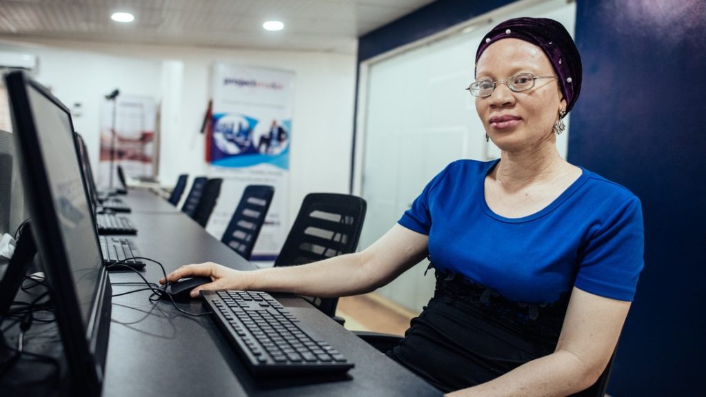 A woman with albinism is sat at a computer and looks at the camera.