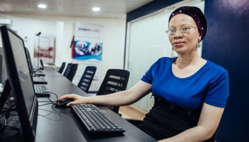 A woman with albinism is sat at a computer and looks at the camera.